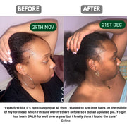 The Ultimate Hair Growth Set for Textured Hair